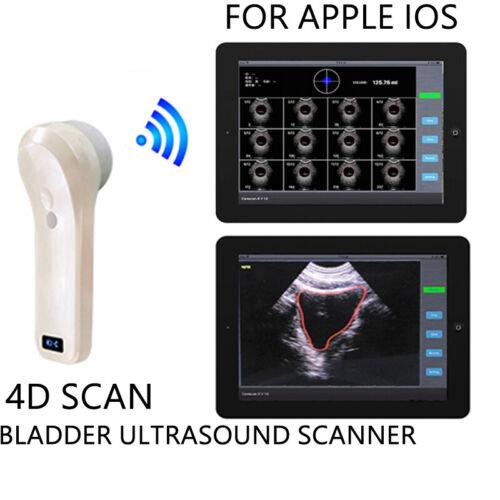 Wireless Ultrasound Scanner Bladder Portable Handheld 4D with Waterproof Probe and USB Connection