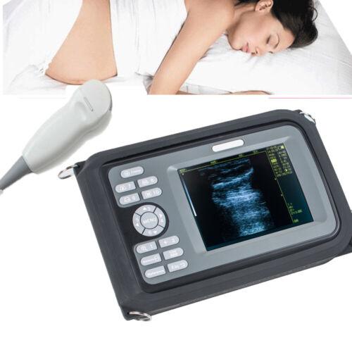 Portable Ultrasound Scanner with Micro-Convex Probe - with 5.5" Color LCD Screen Rechargeable