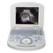 Portable ultrasound scanner with convex probe, fully digital imaging on a 10.4-inch laptop