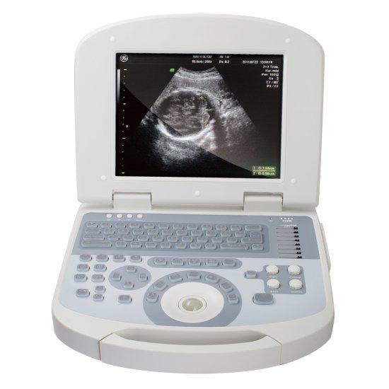 Portable ultrasound scanner with convex probe, fully digital imaging on a 10.4-inch laptop