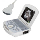 Portable ultrasound scanner with convex probe, fully digital imaging on a 10.4-inch laptop