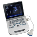 Portable Ultrasound Scanner - Fully digital diagnostic system with 3.5MHz convex probe and 12.1" LED display