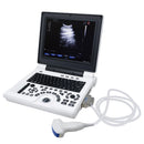 Portable ultrasound diagnostic system with 12.1" LCD screen, convex probe