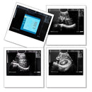 Portable ultrasound scanner with convex probe, fully digital imaging on a 10.4-inch laptop