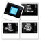 Portable ultrasound scanner with convex probe, fully digital imaging on a 10.4-inch laptop