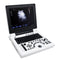 Portable ultrasound diagnostic system with 12.1" LCD screen, convex probe