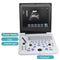 Portable Ultrasound Diagnostic System with 3.5MHz Convex Probe and 12'' Screen