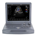 Portable ultrasound scanner with color Doppler, 15" LED screen, convex probe and medical notebook