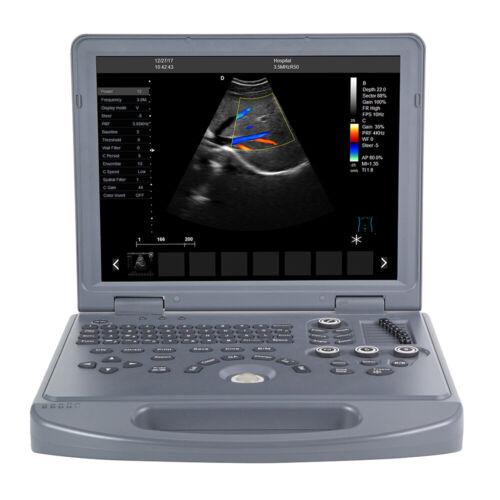 Portable ultrasound scanner with color Doppler, 15" LED screen, convex probe and medical notebook