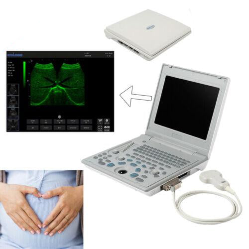 Portable Ultrasound Diagnostic System with 3.5MHz Convex Probe and 12'' Screen