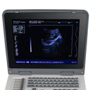 Portable Ultrasound Scanner - Fully digital diagnostic system with 3.5MHz convex probe and 12.1" LED display