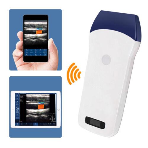 Wireless Ultrasound Scanner Probe with 7.5Mhz Color Doppler and 128 Elements - Portable, WiFi Enabled