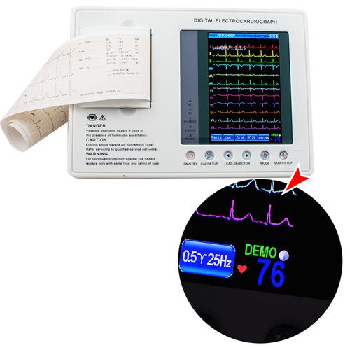 High Precision Electrocardiograph - 3 Channel, 12 Lead Color Screen EKG, LCD Display, Digital Technology