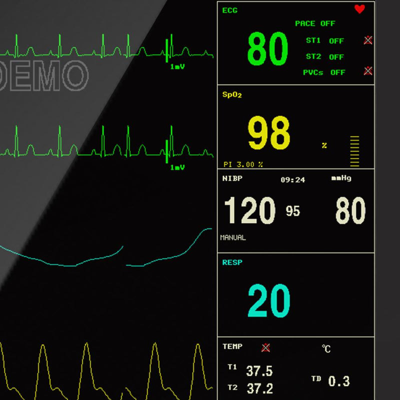 Portable Patient Monitor 12.1" Monitor with ECG, RESP, SpO2, PR, NIBP and TEMP