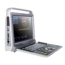 Portable Color Ultrasound Scanner with Digital Doppler System, 2 Probes for Linear & Convex Imaging