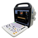 Portable Color Doppler Ultrasound Scanner with 2 Probes