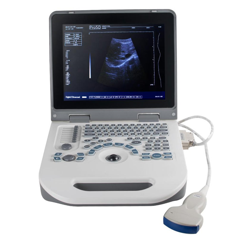 Portable Ultrasound Scanner - Fully digital diagnostic system with 3.5MHz convex probe and 12.1" LED display