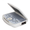 Portable ultrasound scanner with convex probe, fully digital imaging on a 10.4-inch laptop