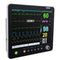 Portable Multi-parameter 15 Inch Touch Screen Vital Sign Patient Monitor ECG NIBP RESP TEMP SPO2 PR