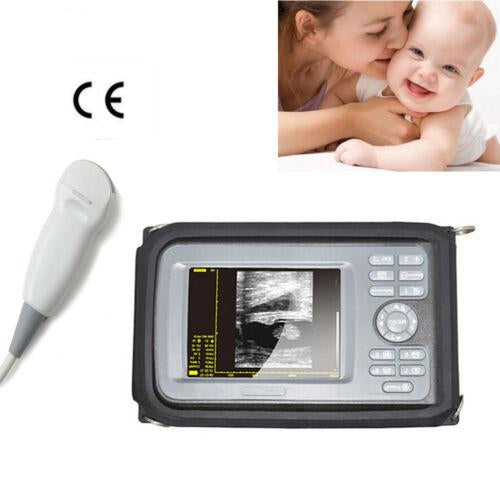 Portable Ultrasound Scanner with Micro-Convex Probe - with 5.5" Color LCD Screen Rechargeable