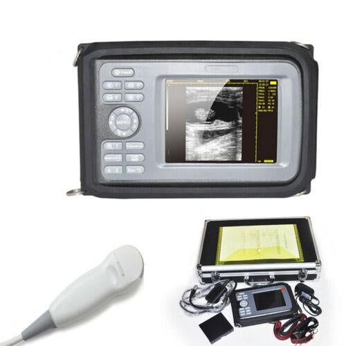 Portable Ultrasound Scanner with Micro-Convex Probe - with 5.5" Color LCD Screen Rechargeable