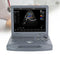 Portable ultrasound scanner with color Doppler, 15" LED screen, convex probe and medical notebook