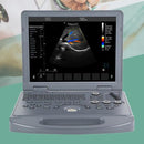 Portable ultrasound scanner with color Doppler, 15" LED screen, convex probe and medical notebook