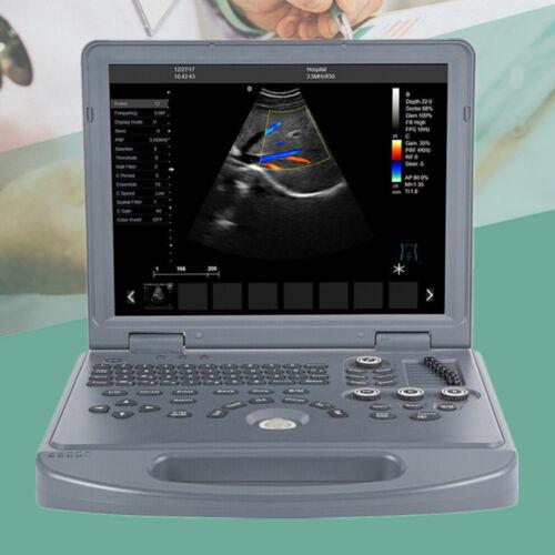 Portable ultrasound scanner with color Doppler, 15" LED screen, convex probe and medical notebook