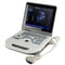 Portable Ultrasound Scanner - Fully digital diagnostic system with 3.5MHz convex probe and 12.1" LED display