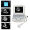 Portable ultrasound scanner with convex probe, fully digital imaging on a 10.4-inch laptop