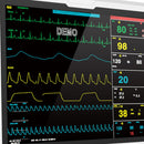 15" Portable Vital Signs Monitor