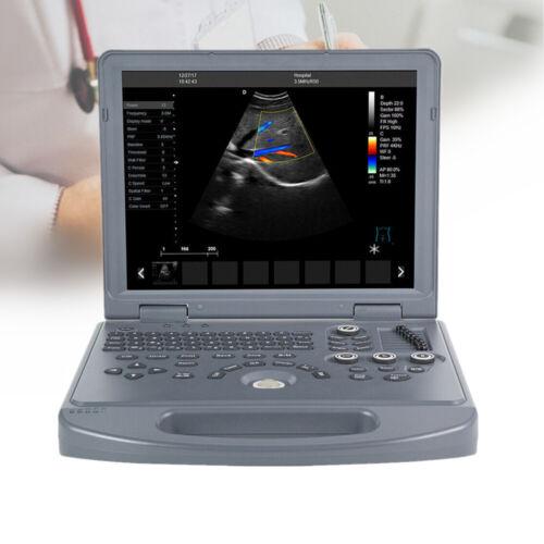 Portable ultrasound scanner with color Doppler, 15" LED screen, convex probe and medical notebook