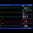 Portable 6-in-1 patient monitor 8-inch high-resolution color display tracks vital signs