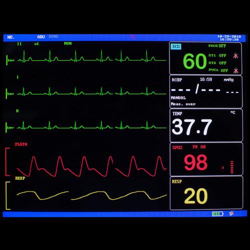 Portable 6-in-1 patient monitor 8-inch high-resolution color display tracks vital signs