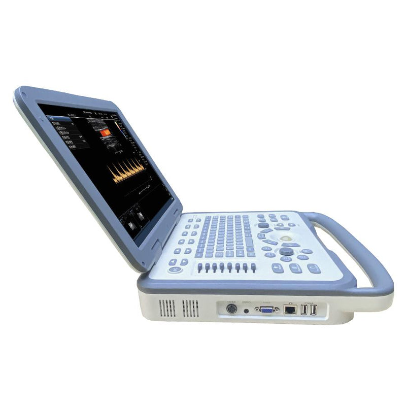 Portable Color Doppler Ultrasound Scanner System with Digital Laptop, Dual Probes - Linear and Convex