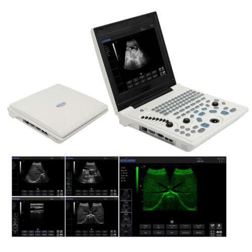 Portable Ultrasound Diagnostic System with 3.5MHz Convex Probe and 12'' Screen