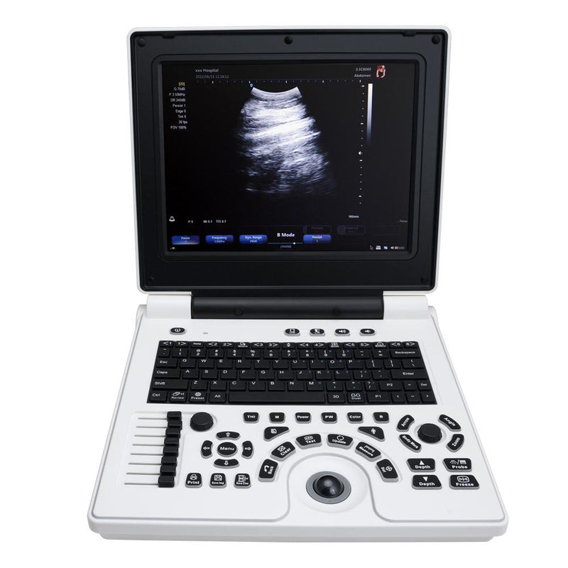 Portable ultrasound diagnostic system with 12.1" LCD screen, convex probe