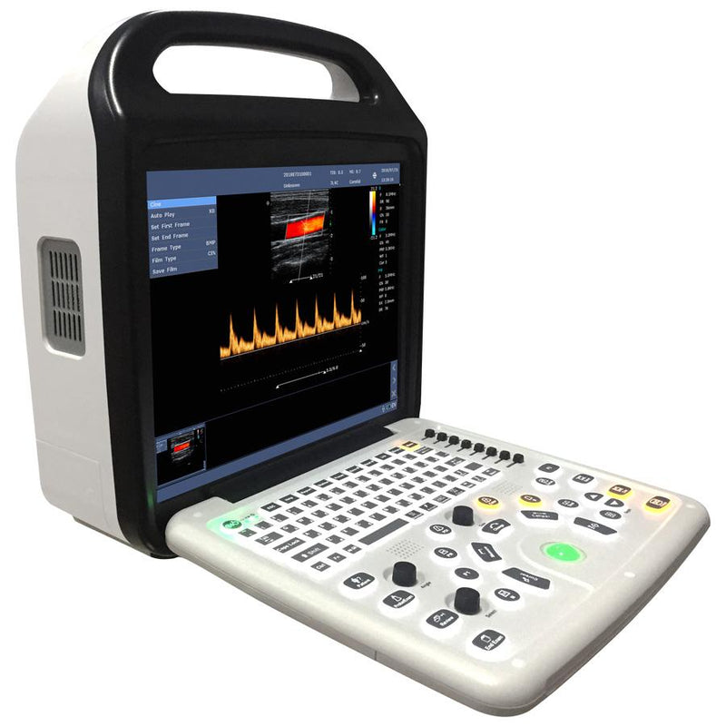 Portable Color Doppler Ultrasound Scanner with 2 Probes