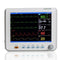 Portable 6-in-1 patient monitor 8-inch high-resolution color display tracks vital signs