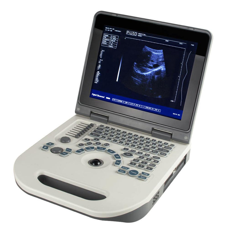 Portable Ultrasound Scanner - Fully digital diagnostic system with 3.5MHz convex probe and 12.1" LED display